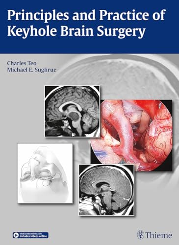 Principles And Practice Of Keyhole Brain Surgery