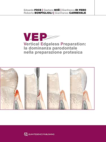 Vep. Vertical Edgeless Preparation: La Dominanza Parodontale Nella Preparazione Protesica