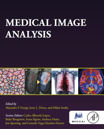 Medical Image Analysis