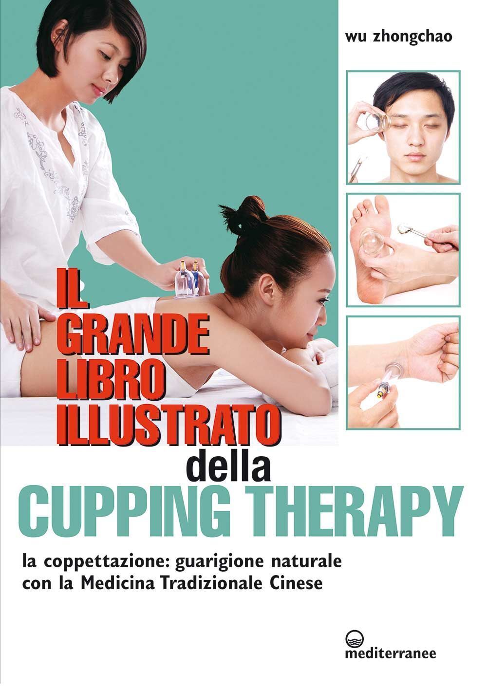 Libri Wu Zhongchao - Il Grande Libro Illustrato Della Cupping Therapy. La Coppet