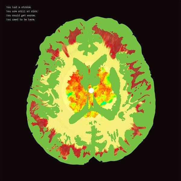 0634457265929 CD Stroke Manor - Minus 5