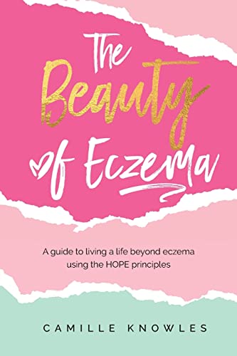 The Beauty Of Eczema: A Guide To Living A Life Beyond Eczema Using The Hope Principles