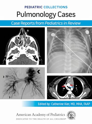 Pediatric Collections: Pulmonology Cases: Case Reports From Pediatrics In Review