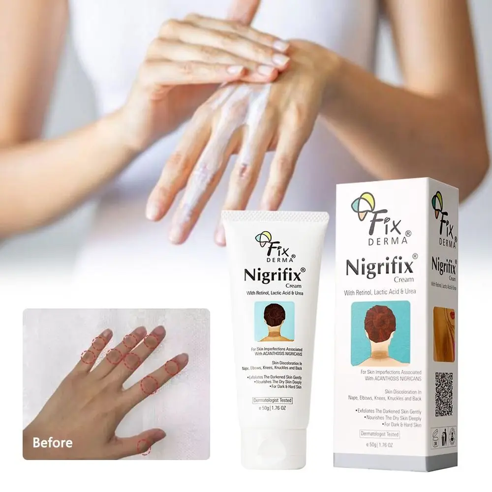 Trattamento Crema Correttore Macchie Scure Fixderma Crema Nigrifix Acantosi Crema Terapia Nigricans Crema Terapia Nigricans