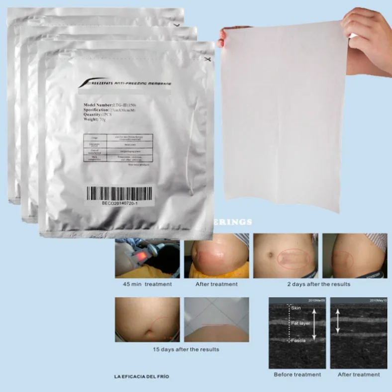 Membrana Anti-Congelamento Per Criolipolisi Corpo Dimagrante 40K Cavitazione Cura Della Pelle Vuoto Corpo Rf Cavitacion Lipolaser Beauty Sali