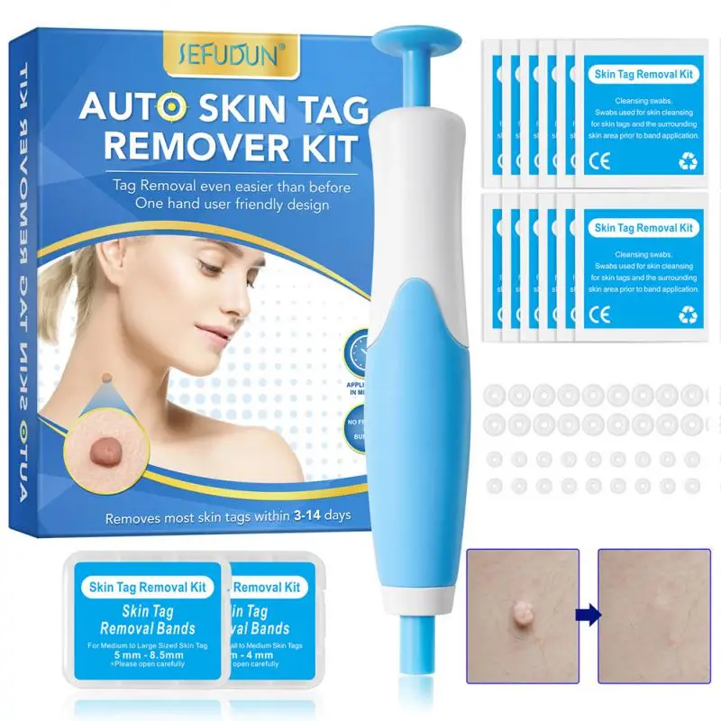 2 In1 Indolore Auto Skin Tag Mole Wart Removal Kit Beauty Health Face Skin Care Body Wart Dot Trattamenti Strumenti Di Pulizia Per La Rimozione