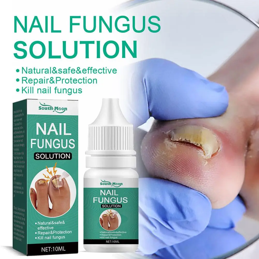 Extra Strong Nail Fungus Treatment Serum Essence Oil Care Essence Toe Nail Gel Antimicotico Riparazione Delle Infezioni Crema Per La Rimozione Dei Pie