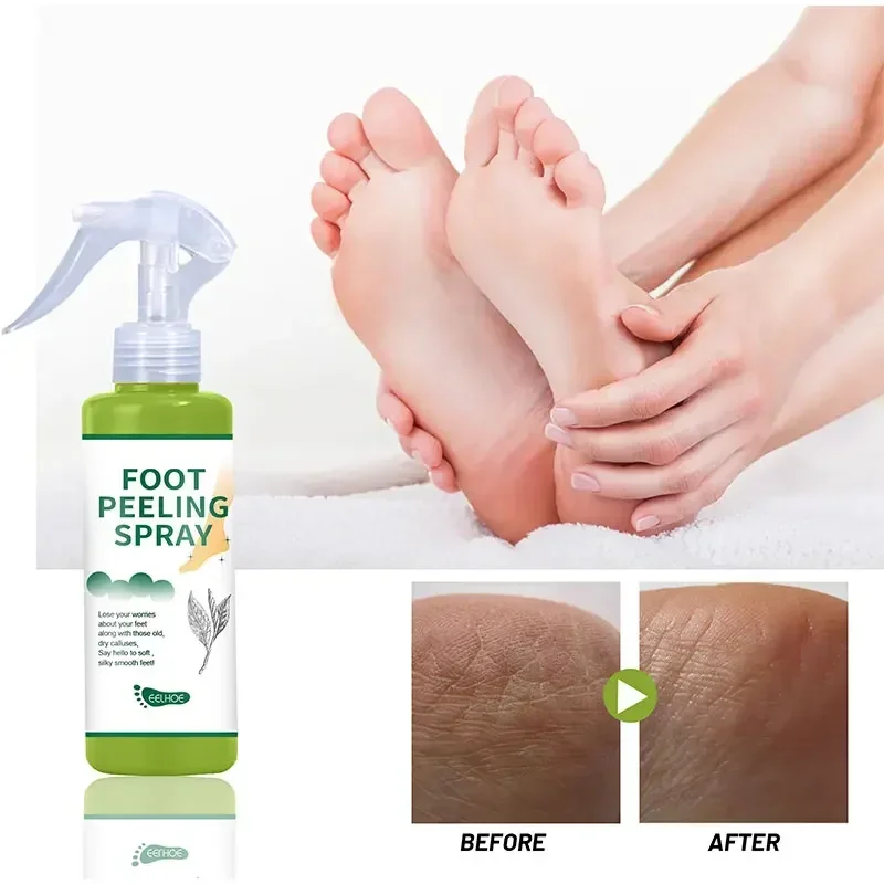 Peeling Per Piedi Spray Detergente Antimicrobico Naturale Arancio Podologico Spray Pedicure Mani Pelle Morta Esfoliante Cura Dei Piedi Detox