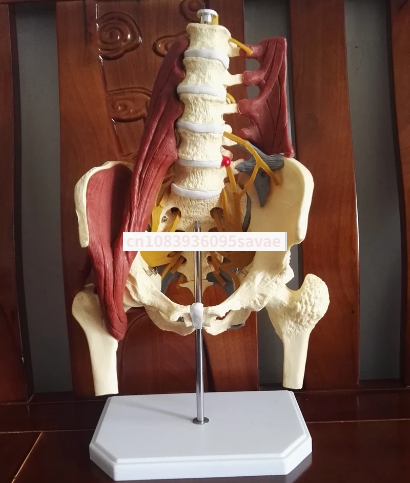 Cintura Lombare Umana Modello Muscolare Disco Lombare Pelvico Ernia Scheletro Sacrale Nella Riparazione Muscolare Del Pavimento Pelvico Materno