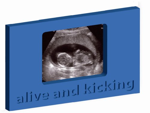 Ver B.V. Mff0207 Myfirst Picture - Cornice Portafoto "Alive And Kicking", Colore: Blu