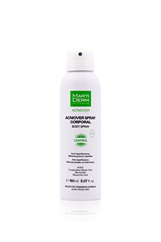 Acniover - Spray Corporal