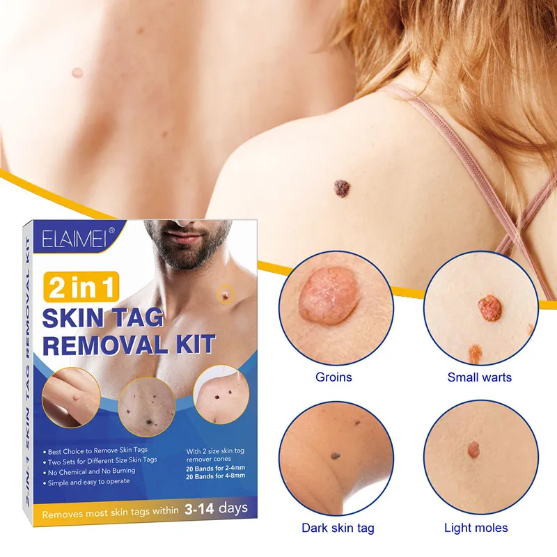2 In 1 Auto Skin Tag Remover Kit Micro Skin Tag Removal Device Adult Mole Stain Wart Remover Cura Del Viso Strumenti Di Bellezza Dropshipping