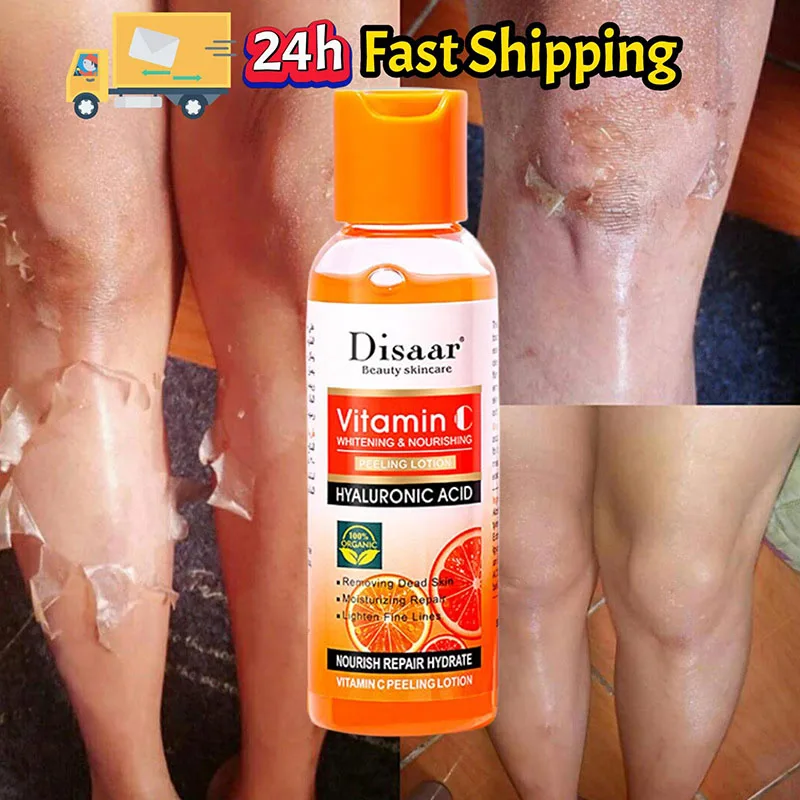 Olio Peeling Per La Pelle Scura Olio Peeling Giallo Super Resistente Olio Peeling Forte Per La Pelle Idratante Schiarente Rimuove I Morti