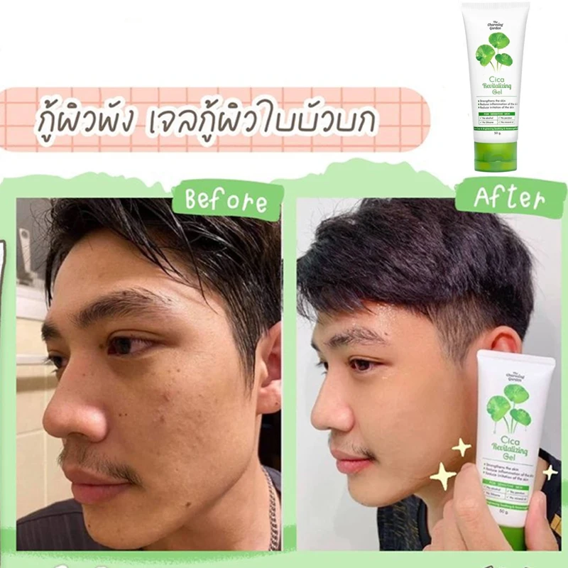 Thailandia Cica Gel Rivitalizzante Riduce Le Cicatrici Da Acne Macchie Scure Pori Dilatati Rughe Idrata Le Aziende Pelle Per Uomo Donna 50G