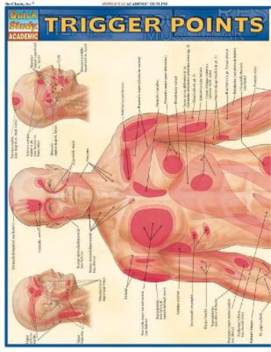 Vincent Perez Trigger Points (Mixed Media Product)