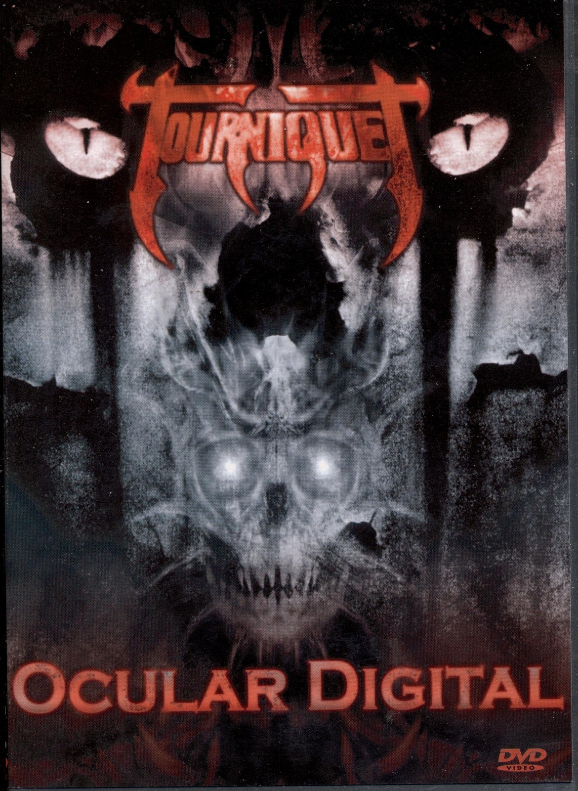 Ocular Digital (DVD) Tourniquet