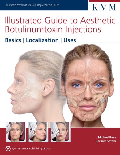 Illustrated Guide To Aesthetic Botulinum Toxin Injections: Basics / Localization / Uses