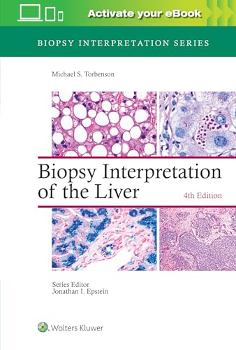 Biopsy Interpretation Of The Liver