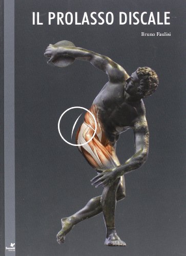 Il Prolasso Discale