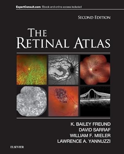 The Retinal Atlas, 2Nd Edition: Expert Consult - Online And Print
