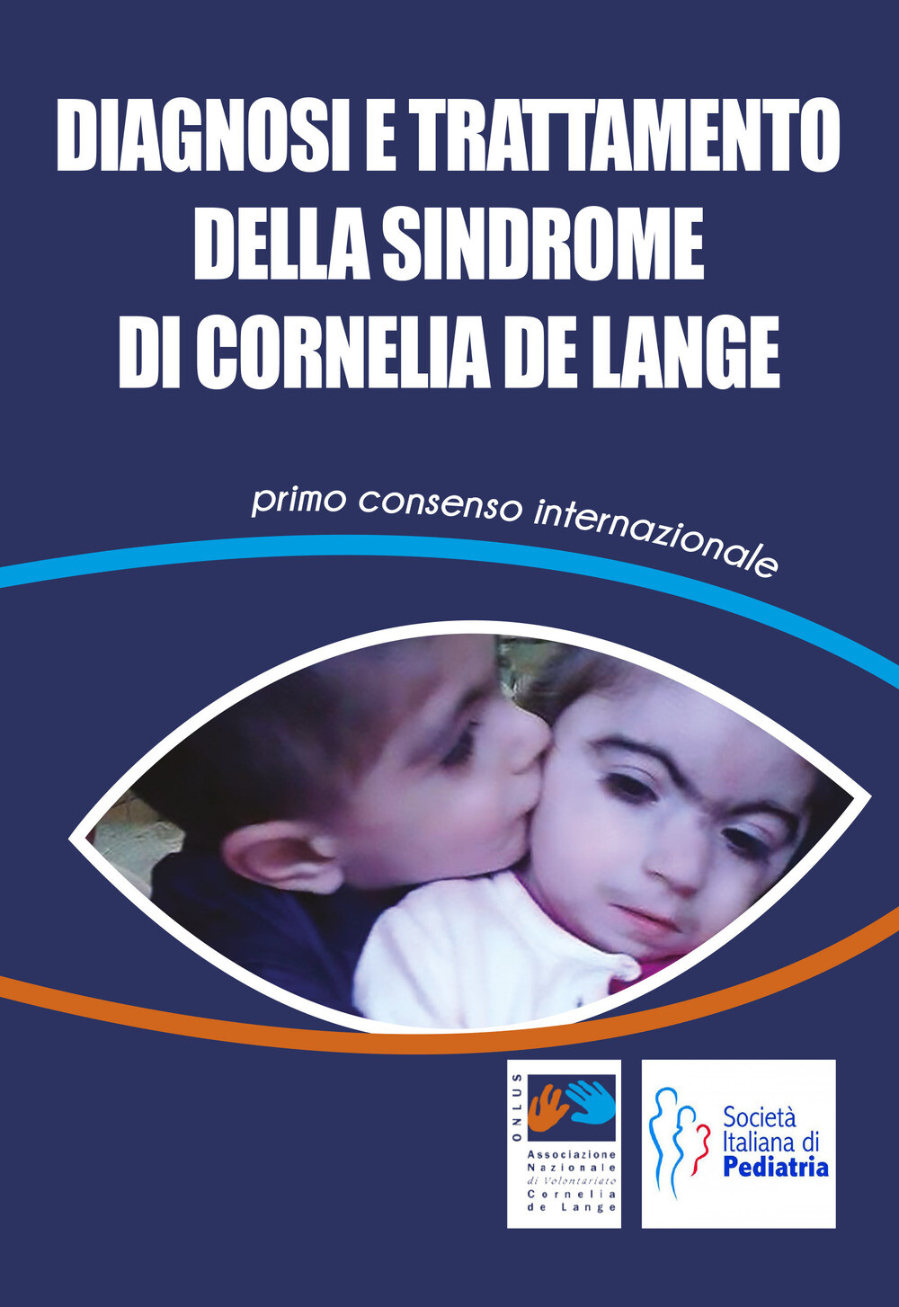 Diagnosi e trattamento della Sindrome di Cornelia De Lange. Primo consenso...
