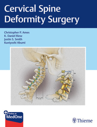 Cervical Spine Deformity Surgery by Christopher P. Ames