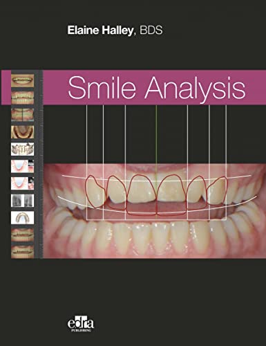 Smile Analysis. Ediz. Italiana
